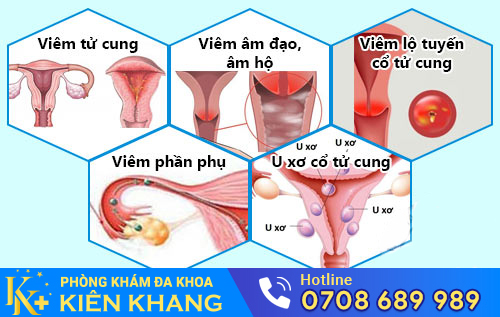 Các bệnh phụ khoa thường gặp