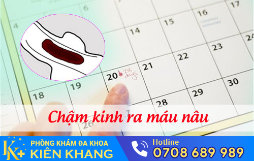 Châm kinh ra máu nâu