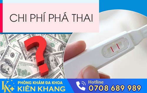 chi phí đình chỉ thai