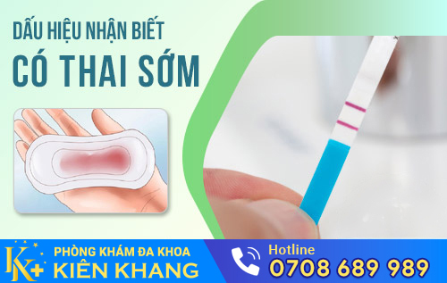 Cách nhận biết có thai sớm