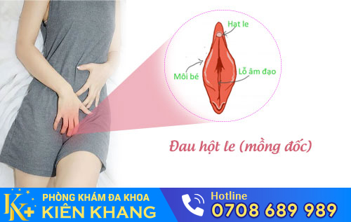 Đau hột le (mồng đốc)