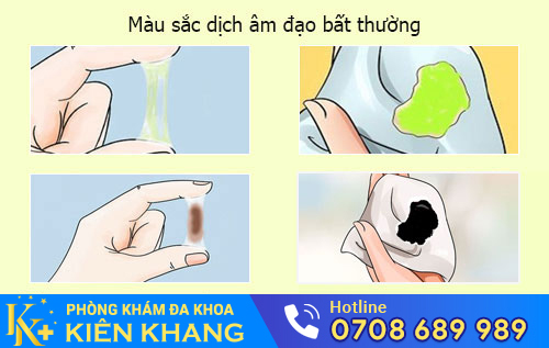 Dịch âm đạo