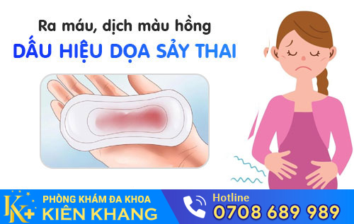 dọa sẩy thai