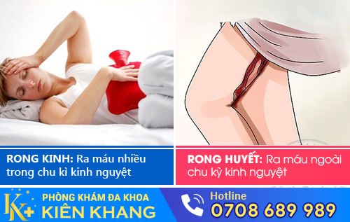 Hiện tượng rong kinh