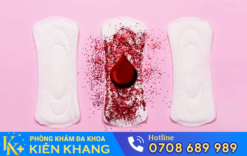Hình ảnh máu kinh vón cục