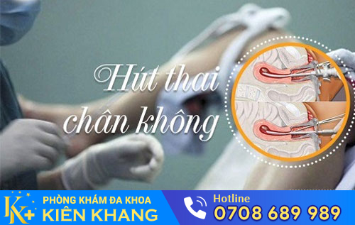 hút thai chân không