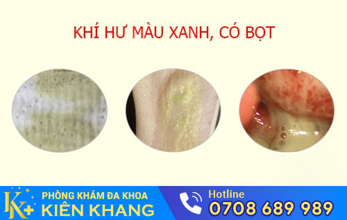 Khí hư màu xanh có bọt