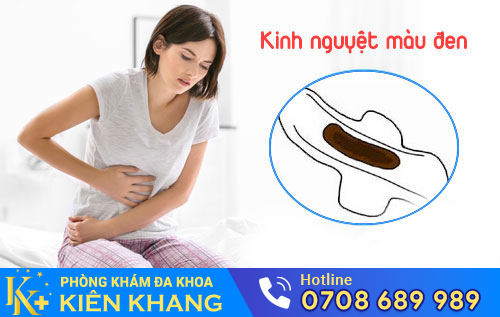 Kinh nguyệt màu đen