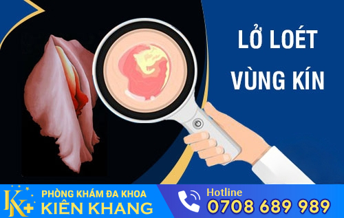 Lở loét vùng kín do bệnh lý