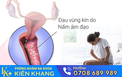 Đau vùng kín là dấu hiệu của nấm âm đạo