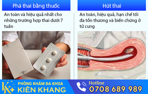 Phương pháp phá thai phụ thuộc vào tuổi thai, sức khỏe thai phụ