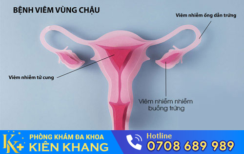 Nguyên nhân gây đau bụng dưới