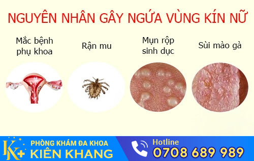 Các nguyên nhân gây ngứa vùng kín nữ