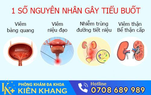 Nguyên nhân gây tiểu buốt