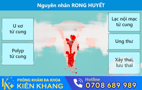 nguyên nhân rong huyết