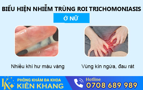 Nhiễm trichomonas ở nữ giới