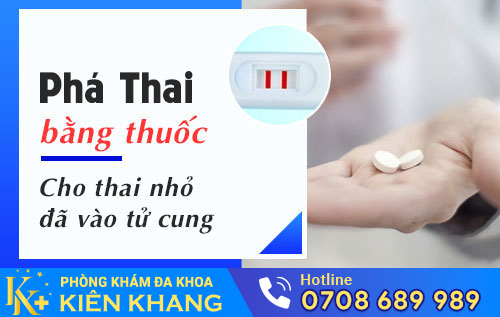 Phá thai bằng thuốc