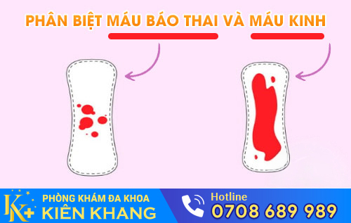 Phân biệt máu báo thai và máu kinh