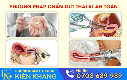 các phương pháp chấm dứt thai kì
