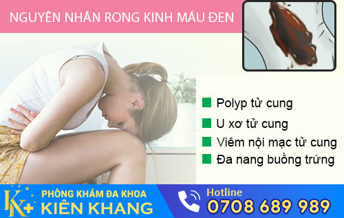 Rong kinh máu đen