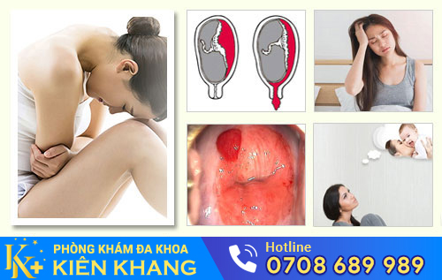 Tác hại của hút thai lưu không an toàn