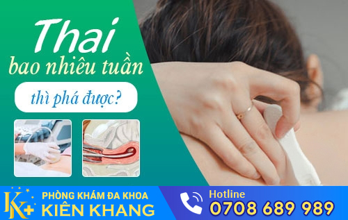 Thời điểm phá thai an toàn nhất là 3 tháng đầu