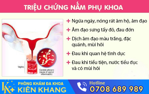 Triệu chứng nấm phụ khoa