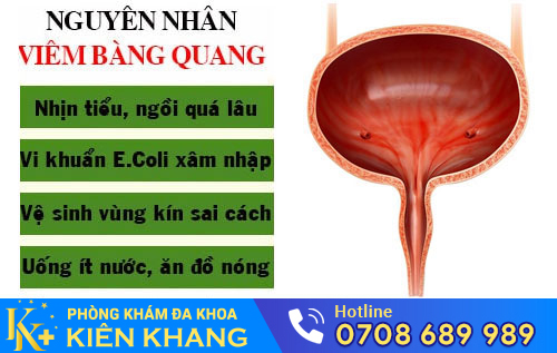 Nguyên nhân viêm bàng quang