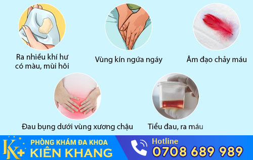 Viêm nhiễm phụ khoa