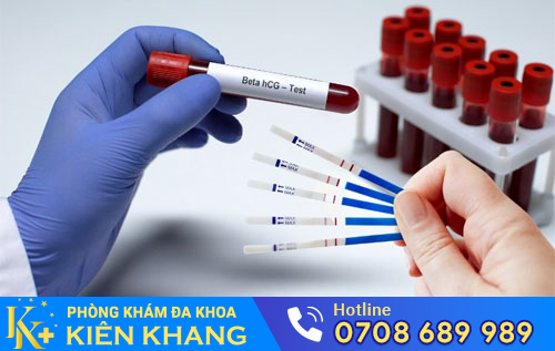 Xét nghiệm HCG kiểm tra thai