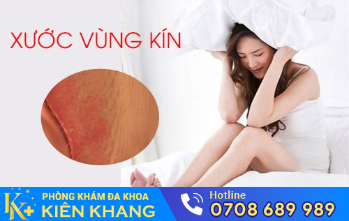 Xước vùng kín có thể do nhiều nguyên nhân