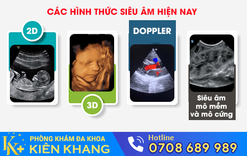 Các hình thức siêu âm hiện nay