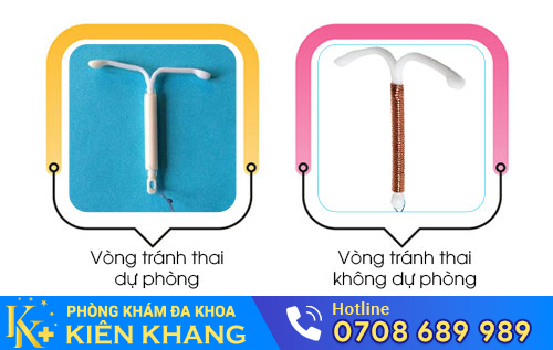 Các loại vòng tránh thai