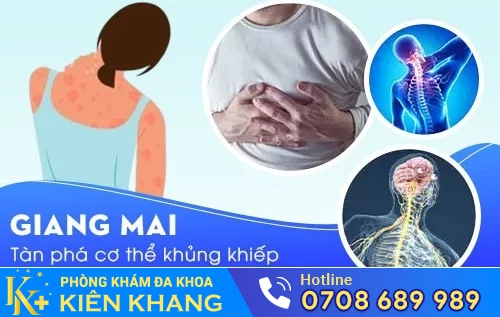 benh giang mai nguy hiem va dieu tri