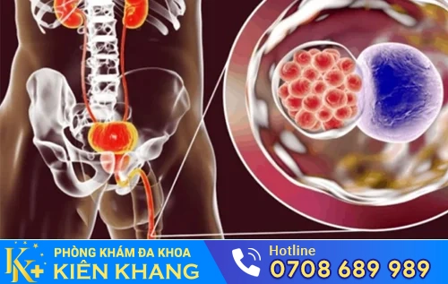 benh hoa lieu benh xa hoi