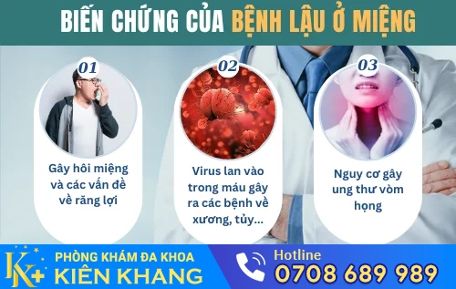 bien chung benh lau o mieng