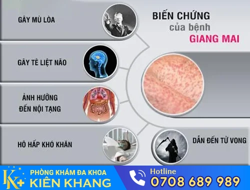 bien chung cua benh giang mai