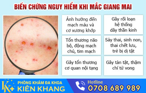 Hình ảnh giang mai giai đoạn cuối
