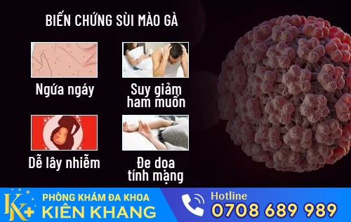 bien chung nguy hiem cua sui mao ga