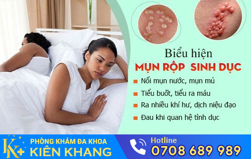 Biểu hiện mụn rộp sinh dục