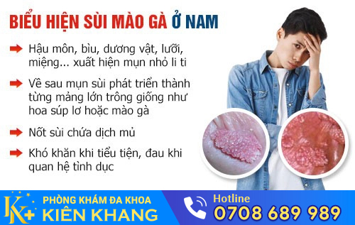Biểu hiện bệnh sùi mào gà