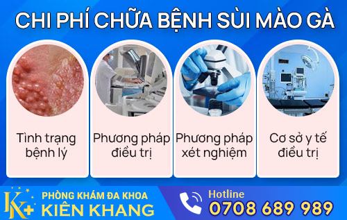 Chi phí chữa bệnh sùi mào gà phụ thuộc vào nhiều yếu tố