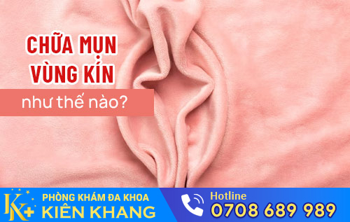 chua mun vung kin nhu the nao