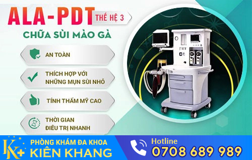 Phương pháp chữa gai sinh dục hiệu quả