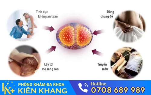 con duong lay nhiem benh lau