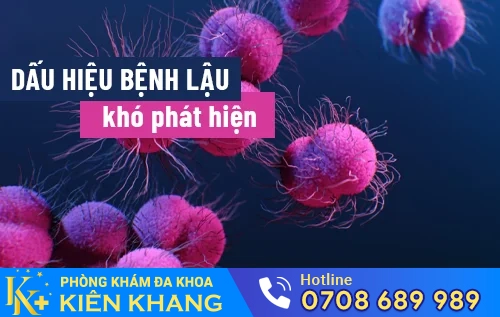 dau hieu benh lau kho phat hien
