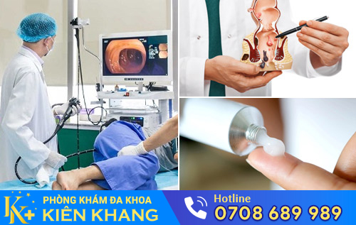 Điều trị bệnh hậu môn, bệnh trĩ