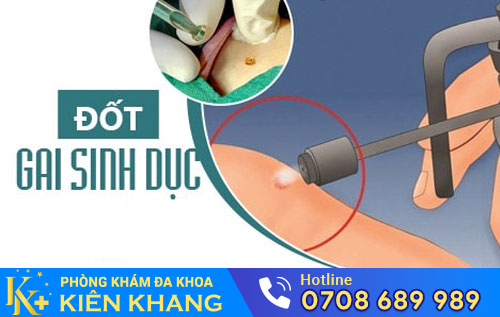 đốt gai sinh dục