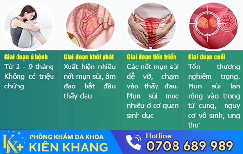 Sùi mào gà ở nữ có thời gian ủ bệnh ngắn hơn