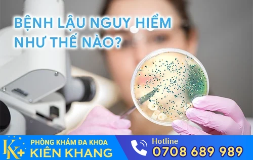 hieu biet benh lau cung bac si chuyen khoa